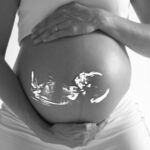 Ultrasound Packages